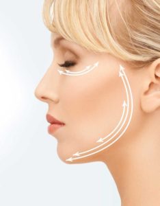 diagram of woman's face overlayed with tightening lines