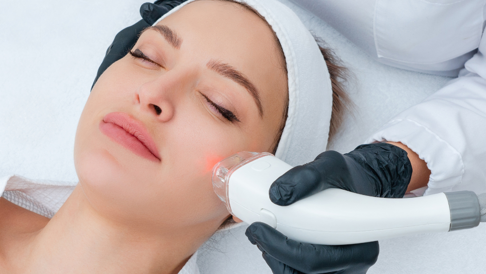 one of the best laser treatments for the face in San Marcos