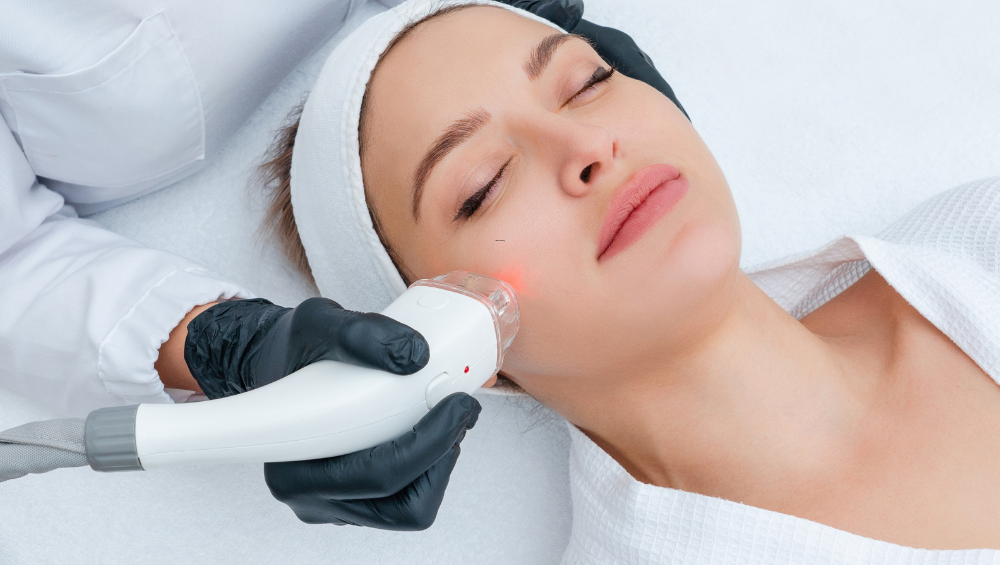 laser skin resurfacing San Marcos