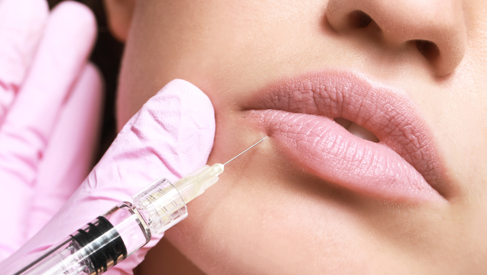 lip filler appointments Temecula